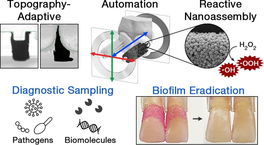 Will microrobots take over brushing and flossing your teeth? Sunset UT