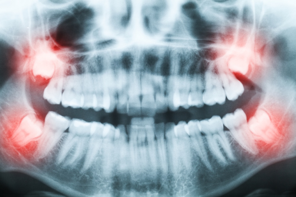 4 Things That Happen During Your Dental Check-Up 4 Things That Happen During Your Dental Check-Up