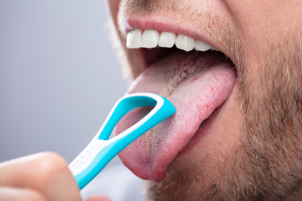 Do you need to brush your tongue?